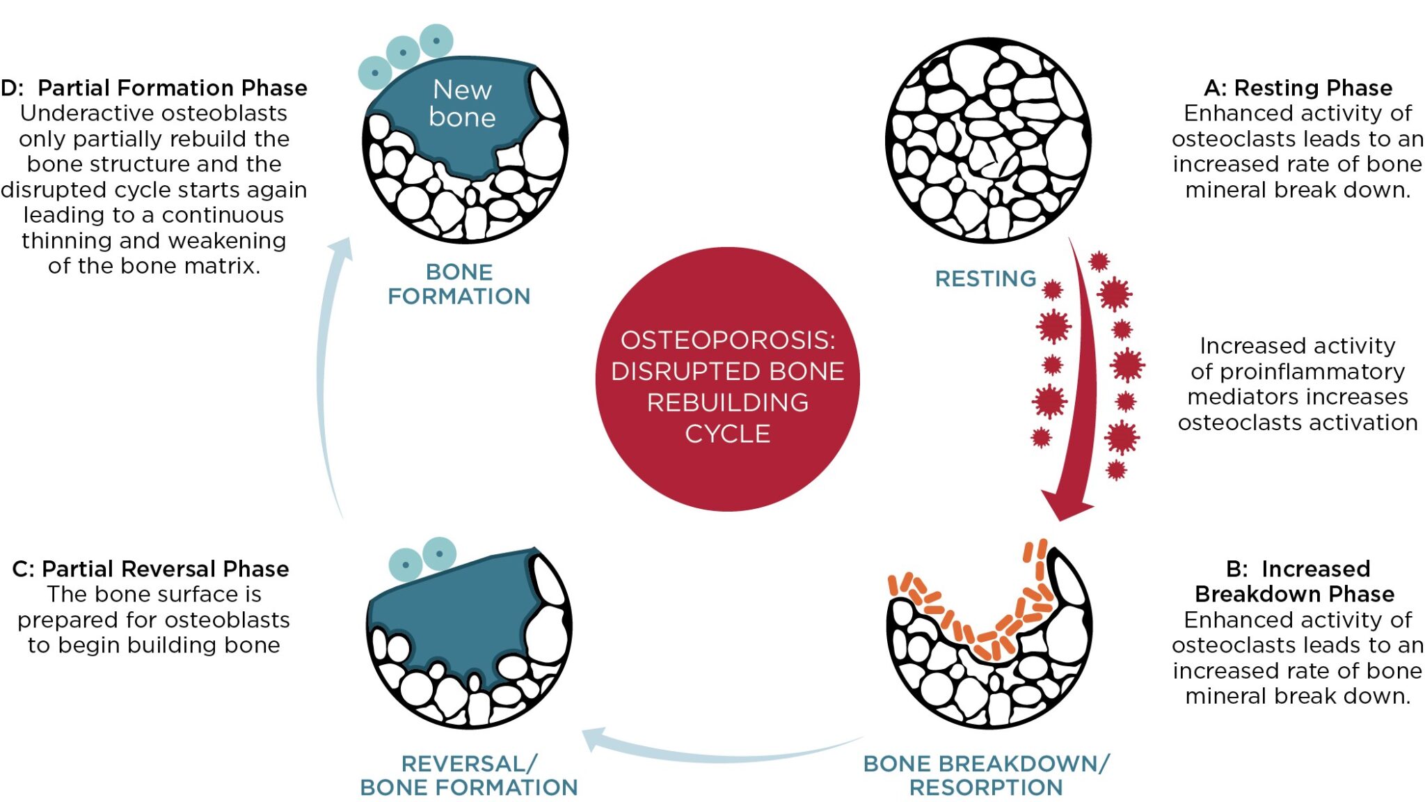 An illustration depicting a disrupted Bone Rebuilding Cycle as a result of Osteoporosis