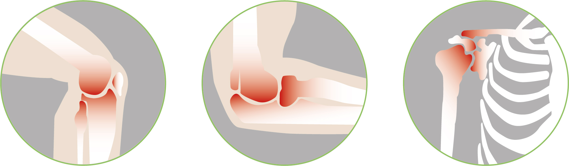 Image of commonly affected joints under conditions such as Osteoarthritis