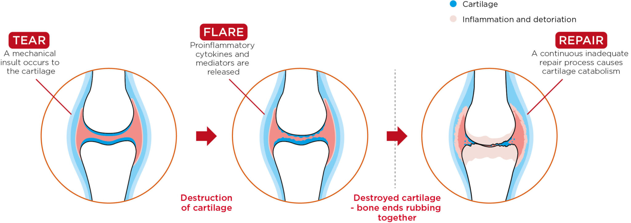 An illustration of the compromised joint repair process